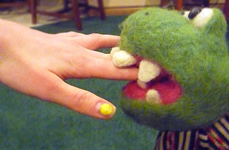 …Ouch!…and teeth!!!